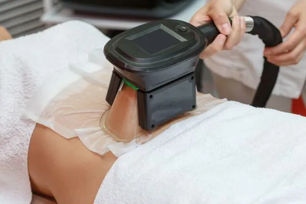 Image of person having fat freezing treatment to help weight gain Lancashire