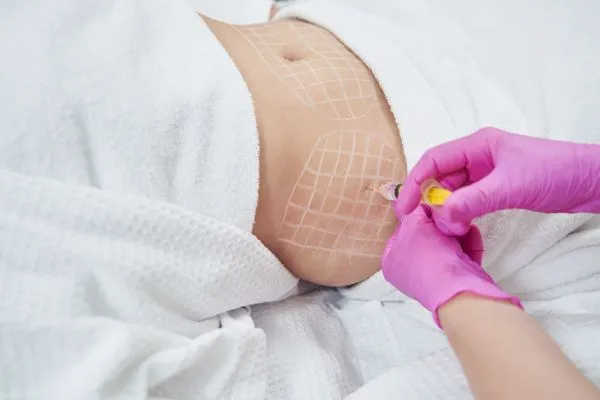 image of fat dissolving injections on love handles to help combat weight gain Lancashire