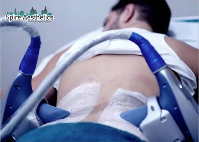 Man having fat freezing treatment done on love handles before a competitions Lancashire to create a sculpted look.