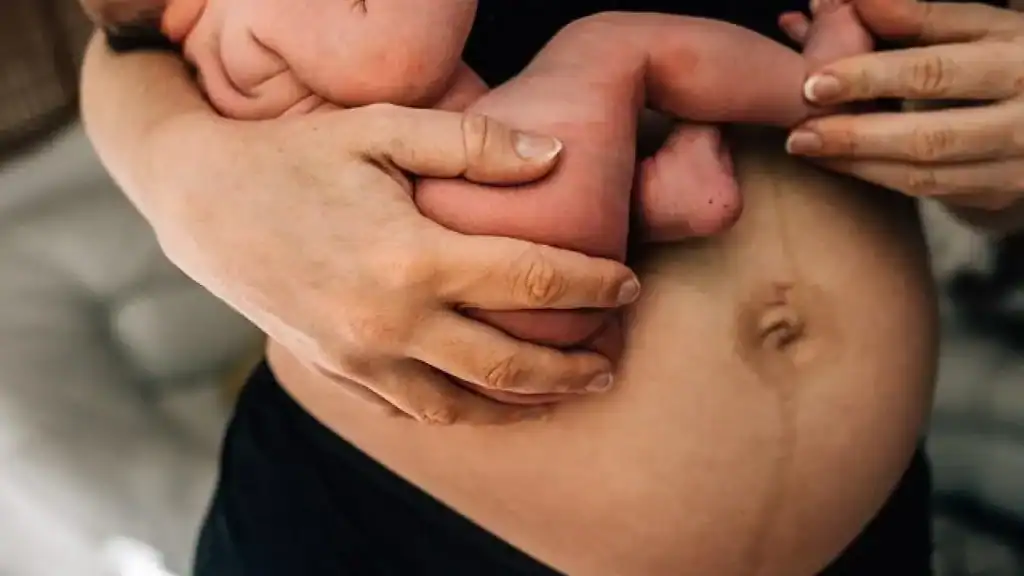 Why Is My Stomach Still Big After Pregnancy Lancashire?