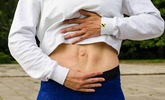When Could Diastasis Recti Be the Missing Piece of the Puzzle Lancashire?